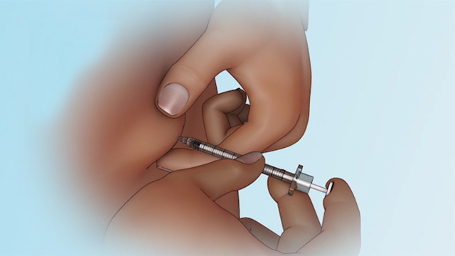 Injecting Insulin Using a Syringe